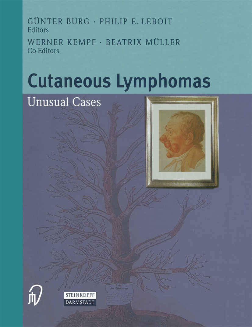 Titlebook: Cutaneous Lymphomas; Unusual Cases Günter Burg (Professor of Dermatology and Venerolo Book 2001 Springer-Verlag Berlin Heidelberg 2001 Derm Titlebook: Cutaneous Lymphomas; Unusual Cases Günter Burg (Professor of Dermatology and Venerolo Book 2001 Springer-Verlag Berlin Heidelberg 2001 Derm
