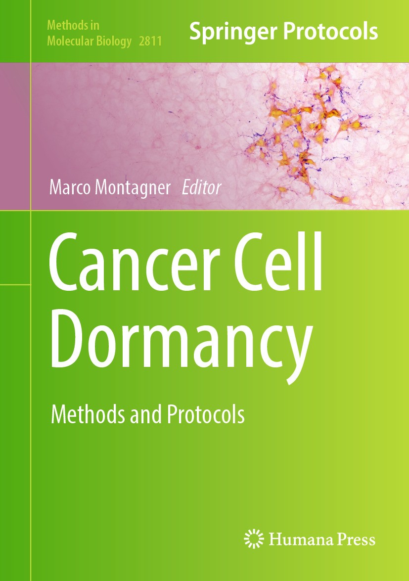 Titlebook: Cancer Cell Dormancy; Methods and Protocol Marco Montagner Book 2024 The Editor(s) (if applicable) and The Author(s), under exclusive licen Titlebook: Cancer Cell Dormancy; Methods and Protocol Marco Montagner Book 2024 The Editor(s) (if applicable) and The Author(s), under exclusive licen