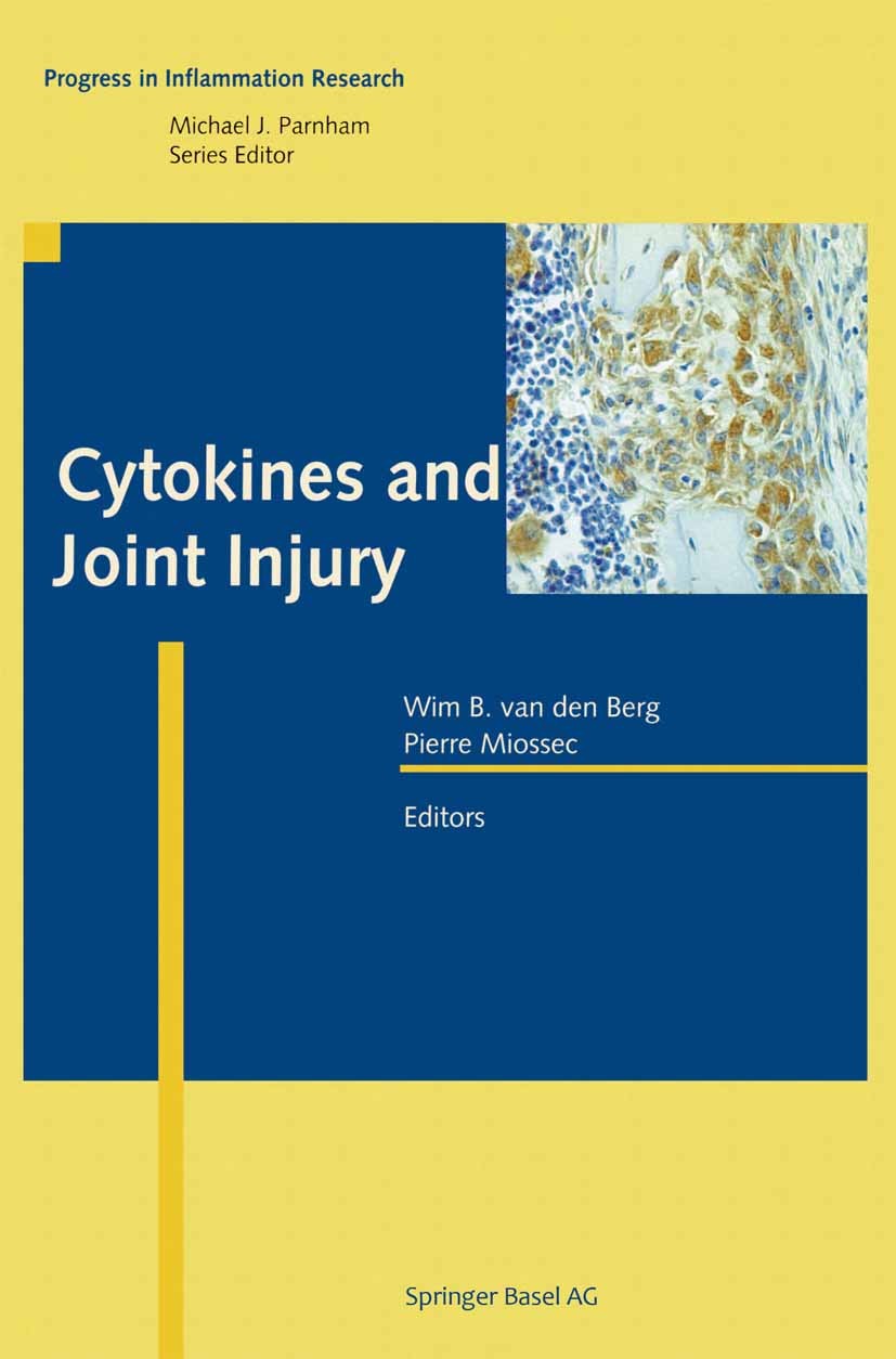 Titlebook: Cytokines and Joint Injury; Wim B. Berg,Pierre Miossec Book 2004 Springer Basel AG 2004 Arthritis.bone.cytokine.cytokines.diseases.inflamm Titlebook: Cytokines and Joint Injury; Wim B. Berg,Pierre Miossec Book 2004 Springer Basel AG 2004 Arthritis.bone.cytokine.cytokines.diseases.inflamm