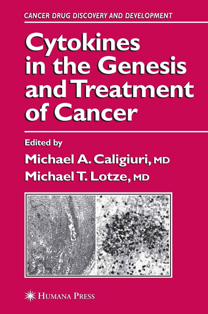 Titlebook: Cytokines in the Genesis and Treatment of Cancer; Michael A. Caligiuri,Michael T. Lotze (Director) Book 2007 Humana Press 2007 Chemokine.T Titlebook: Cytokines in the Genesis and Treatment of Cancer; Michael A. Caligiuri,Michael T. Lotze (Director) Book 2007 Humana Press 2007 Chemokine.T