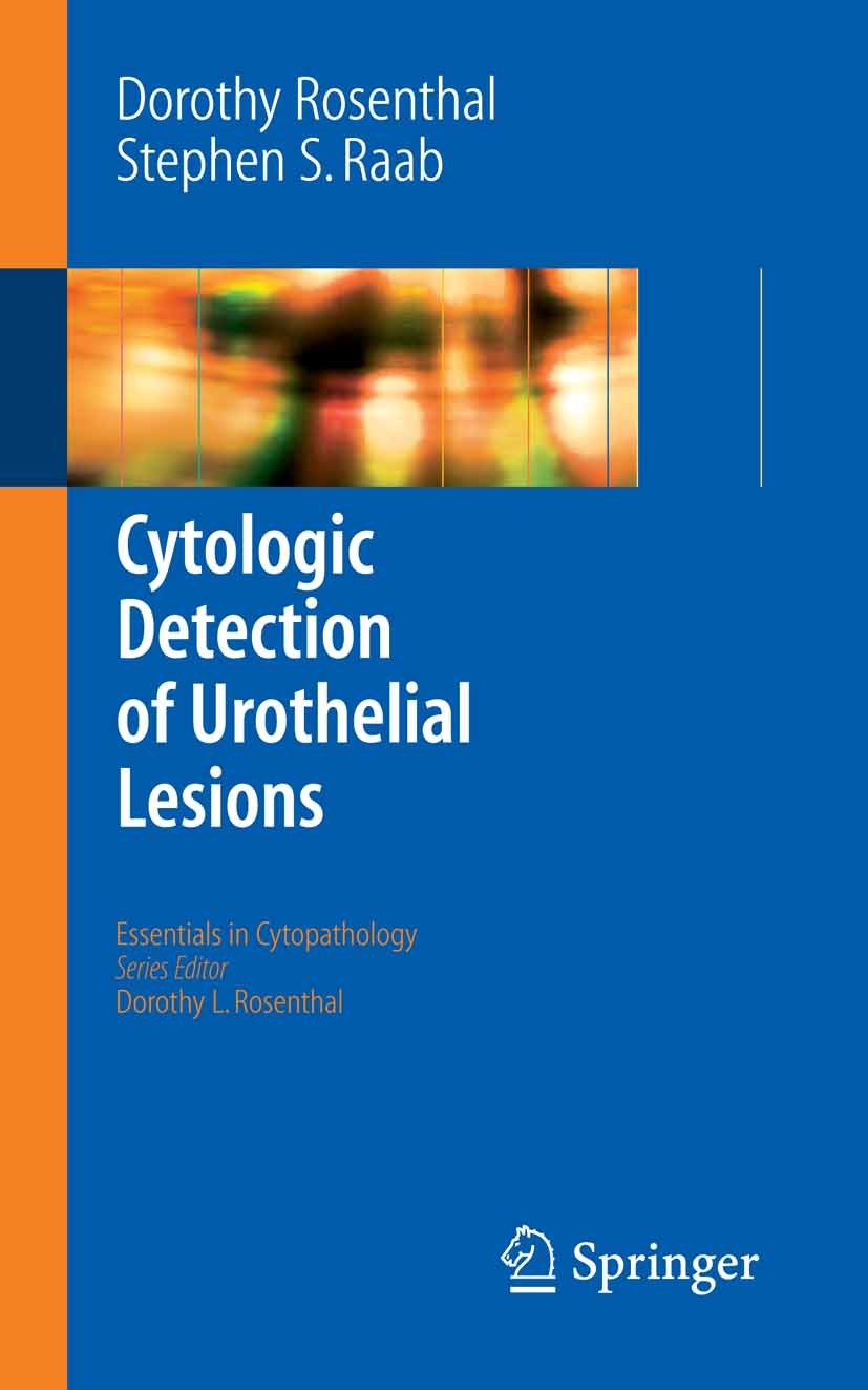 Titlebook: Cytologic Detection of Urothelial Lesions; Dorothy L. Rosenthal,Stephen S. Raab Book 2006 Springer-Verlag New York 2006 Grading.carcinoma. Titlebook: Cytologic Detection of Urothelial Lesions; Dorothy L. Rosenthal,Stephen S. Raab Book 2006 Springer-Verlag New York 2006 Grading.carcinoma.