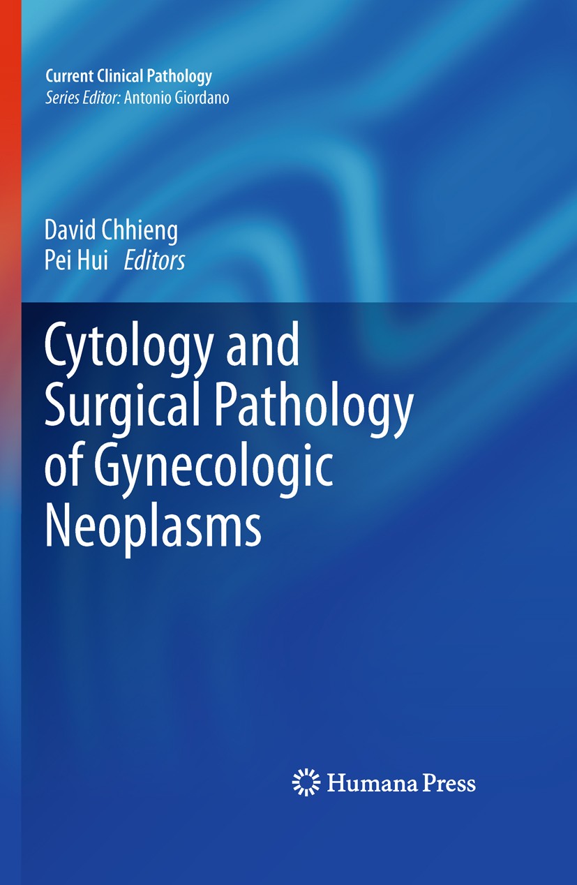Titlebook: Cytology and Surgical Pathology of Gynecologic Neoplasms; David Chhieng,Pei Hui Book 2011 The Editor(s) (if applicable) and The Author(s), Titlebook: Cytology and Surgical Pathology of Gynecologic Neoplasms; David Chhieng,Pei Hui Book 2011 The Editor(s) (if applicable) and The Author(s),
