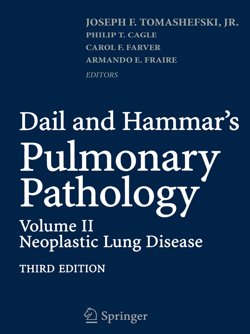 Titlebook: Dail and Hammar‘s Pulmonary Pathology; Volume II: Neoplasti Joseph F. Tomashefski (Professor, Chairman),Philip Book 2008Latest edition Spri Titlebook: Dail and Hammar‘s Pulmonary Pathology; Volume II: Neoplasti Joseph F. Tomashefski (Professor, Chairman),Philip Book 2008Latest edition Spri