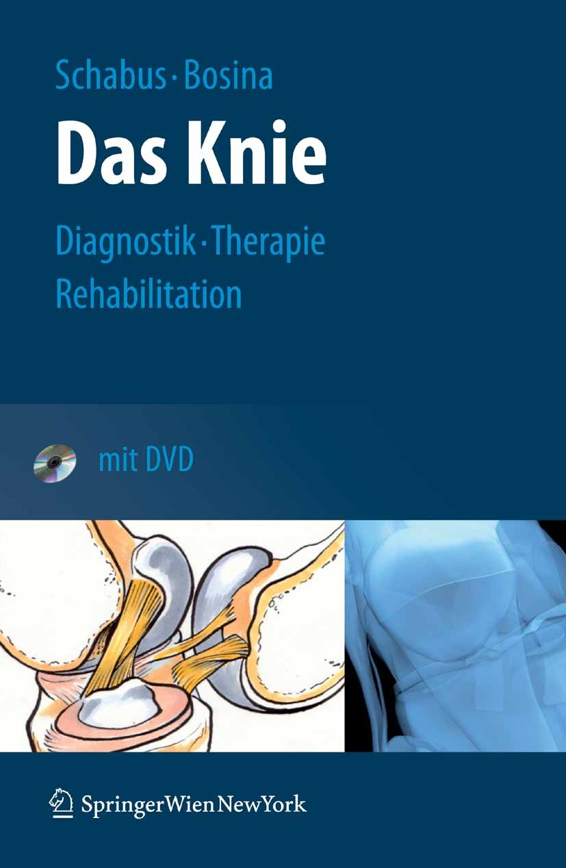 Titlebook: Das Knie; Diagnostik – Therapi Rudolf Schabus,Elisabeth Bosina Book 2007 Springer-Verlag Vienna 2007 Arthrose.Arthroskopie.Fraktur.Gelenkst Titlebook: Das Knie; Diagnostik – Therapi Rudolf Schabus,Elisabeth Bosina Book 2007 Springer-Verlag Vienna 2007 Arthrose.Arthroskopie.Fraktur.Gelenkst