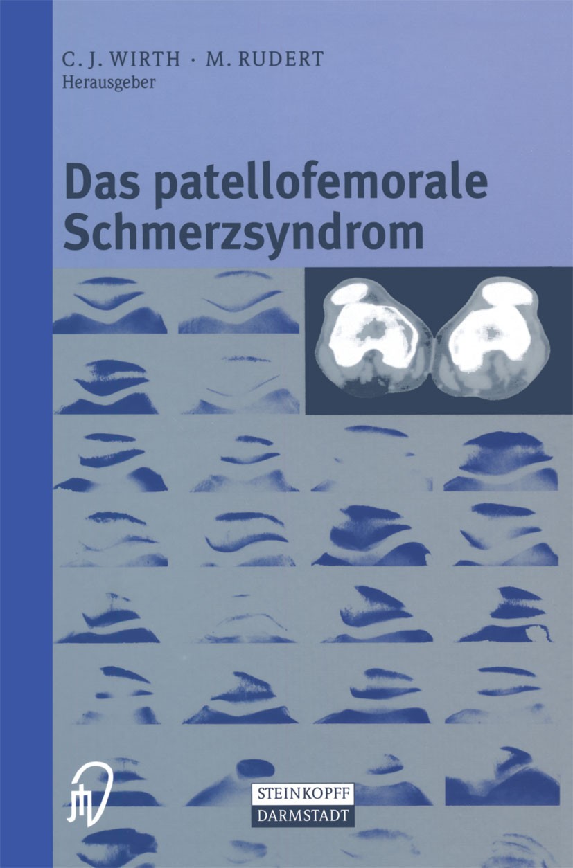 Titlebook: Das patellofemorale Schmerzsyndrom; Carl Joachim Wirth,Maximilian Rudert Book 2000 Springer-Verlag Berlin Heidelberg 2000 Arthrose.Bandage Titlebook: Das patellofemorale Schmerzsyndrom; Carl Joachim Wirth,Maximilian Rudert Book 2000 Springer-Verlag Berlin Heidelberg 2000 Arthrose.Bandage