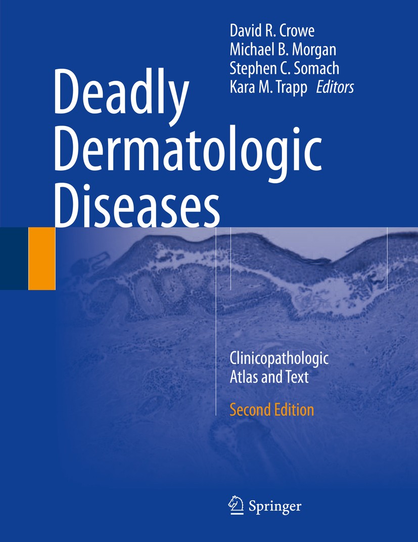 Titlebook: Deadly Dermatologic Diseases; Clinicopathologic At David R. Crowe,Michael Morgan,Kara Trapp Book 2016Latest edition Springer International Titlebook: Deadly Dermatologic Diseases; Clinicopathologic At David R. Crowe,Michael Morgan,Kara Trapp Book 2016Latest edition Springer International