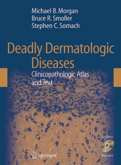 Titlebook: Deadly Dermatologic Diseases; Clinicopathologic At Michael B. Morgan,Bruce R. Smoller,Stephen C. Soma Book 20071st edition Springer-Verlag Titlebook: Deadly Dermatologic Diseases; Clinicopathologic At Michael B. Morgan,Bruce R. Smoller,Stephen C. Soma Book 20071st edition Springer-Verlag