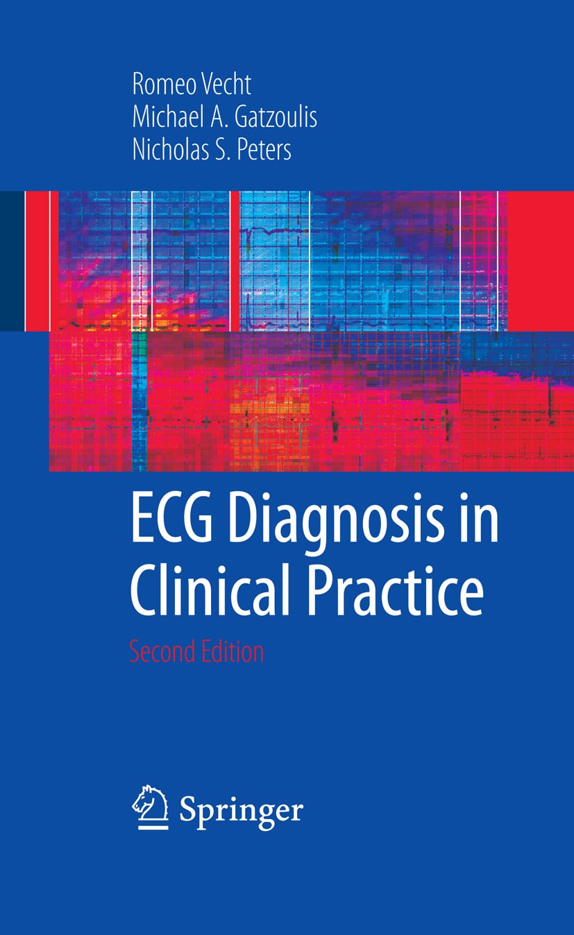 Titlebook: ECG Diagnosis in Clinical Practice; Nicholas Peters,Michael A. Gatzoulis,Romeo Vecht Book 2009Latest edition The Editor(s) (if applicable) Titlebook: ECG Diagnosis in Clinical Practice; Nicholas Peters,Michael A. Gatzoulis,Romeo Vecht Book 2009Latest edition The Editor(s) (if applicable)
