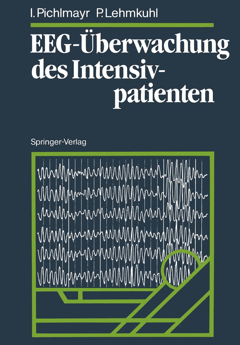 Titlebook: EEG-Überwachung des Intensivpatienten; Ina Pichlmayr,Peter Lehmkuhl Book 1988 Springer-Verlag Berlin Heidelberg 1988 Anästhesiologie.Beatm Titlebook: EEG-Überwachung des Intensivpatienten; Ina Pichlmayr,Peter Lehmkuhl Book 1988 Springer-Verlag Berlin Heidelberg 1988 Anästhesiologie.Beatm
