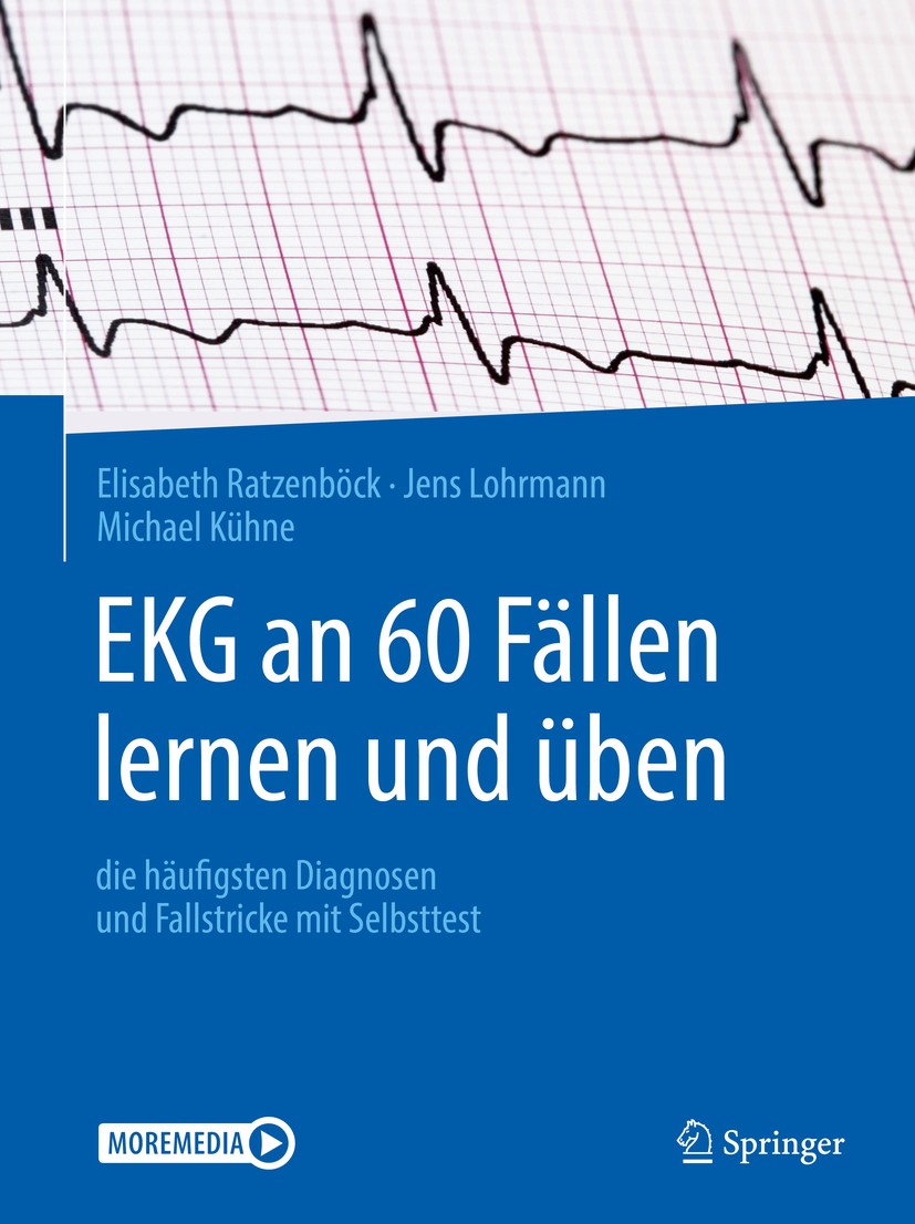 Titlebook: EKG an 60 Fällen lernen und üben; die häufigsten Diagn Elisabeth Ratzenböck,Jens Lohrmann,Michael Kühne Book 2020 Springer-Verlag GmbH Deut Titlebook: EKG an 60 Fällen lernen und üben; die häufigsten Diagn Elisabeth Ratzenböck,Jens Lohrmann,Michael Kühne Book 2020 Springer-Verlag GmbH Deut