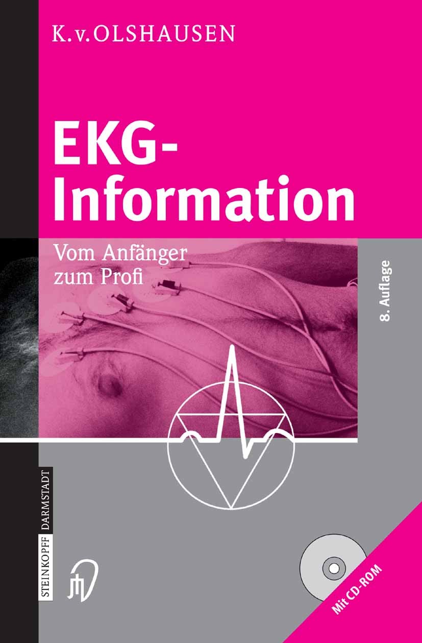 Titlebook: EKG-Information; Vom Anfänger zum Pro Klaus E. Olshausen Book 2005Latest edition Steinkopff-Verlag Darmstadt 2005 Arterielle Hypertonie.EKG Titlebook: EKG-Information; Vom Anfänger zum Pro Klaus E. Olshausen Book 2005Latest edition Steinkopff-Verlag Darmstadt 2005 Arterielle Hypertonie.EKG