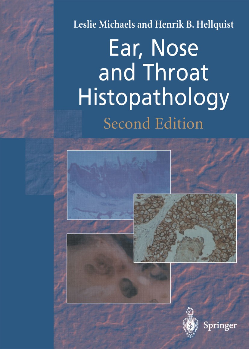 Titlebook: Ear, Nose and Throat Histopathology; Leslie Michaels,Henrik B. Hellquist Book 2001Latest edition Springer-Verlag London 2001 Otorhinolaryn Titlebook: Ear, Nose and Throat Histopathology; Leslie Michaels,Henrik B. Hellquist Book 2001Latest edition Springer-Verlag London 2001 Otorhinolaryn