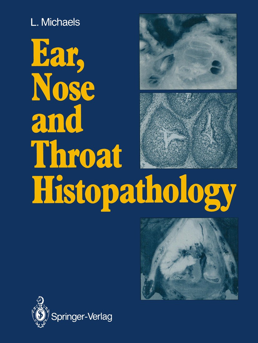 Titlebook: Ear, Nose and Throat Histopathology; L. Michaels Book 19871st edition Springer-Verlag Berlin Heidelberg 1987 Otorhinolaryngology(ENT).biop Titlebook: Ear, Nose and Throat Histopathology; L. Michaels Book 19871st edition Springer-Verlag Berlin Heidelberg 1987 Otorhinolaryngology(ENT).biop