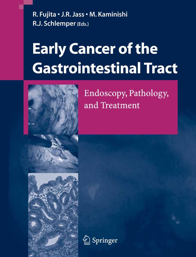 Titlebook: Early Cancer of the Gastrointestinal Tract; Endoscopy, Pathology Rikiya Fujita (Chief of Endoscopy Division),Jeremy Book 2006 Springer-Verl Titlebook: Early Cancer of the Gastrointestinal Tract; Endoscopy, Pathology Rikiya Fujita (Chief of Endoscopy Division),Jeremy Book 2006 Springer-Verl