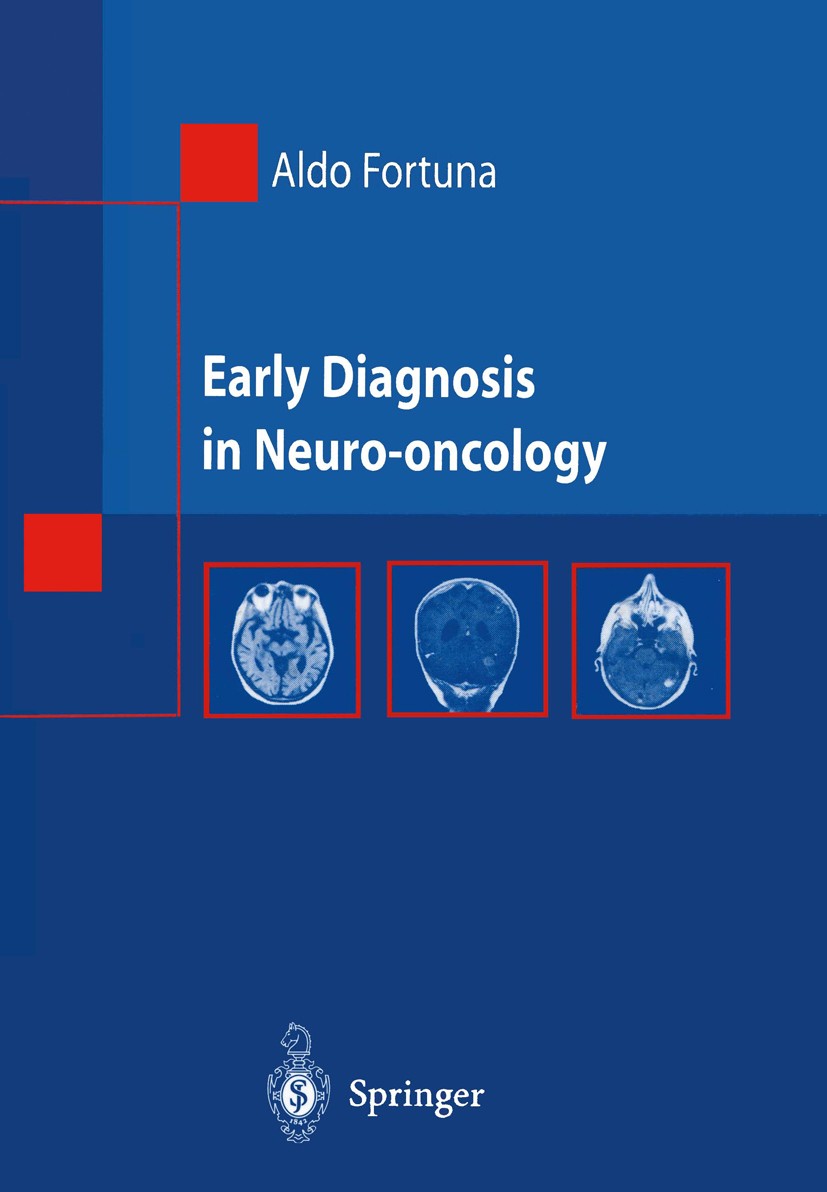 Titlebook: Early Diagnosis in Neuro-oncology; Aldo Fortuna Textbook 2002 Springer-Verlag Italia, Milan 2002 Tumor.diagnosis.lymphoma.metastasis.neuro Titlebook: Early Diagnosis in Neuro-oncology; Aldo Fortuna Textbook 2002 Springer-Verlag Italia, Milan 2002 Tumor.diagnosis.lymphoma.metastasis.neuro