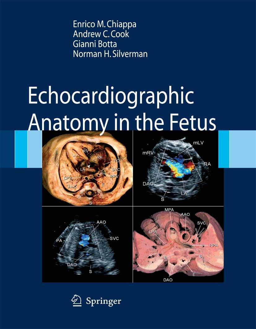 Titlebook: Echocardiographic Anatomy in the Fetus; Enrico M. Chiappa,Andrew C. Cook,Norman H. Silverm Book 2008 Springer-Verlag Italia S.r.l., part o Titlebook: Echocardiographic Anatomy in the Fetus; Enrico M. Chiappa,Andrew C. Cook,Norman H. Silverm Book 2008 Springer-Verlag Italia S.r.l., part o