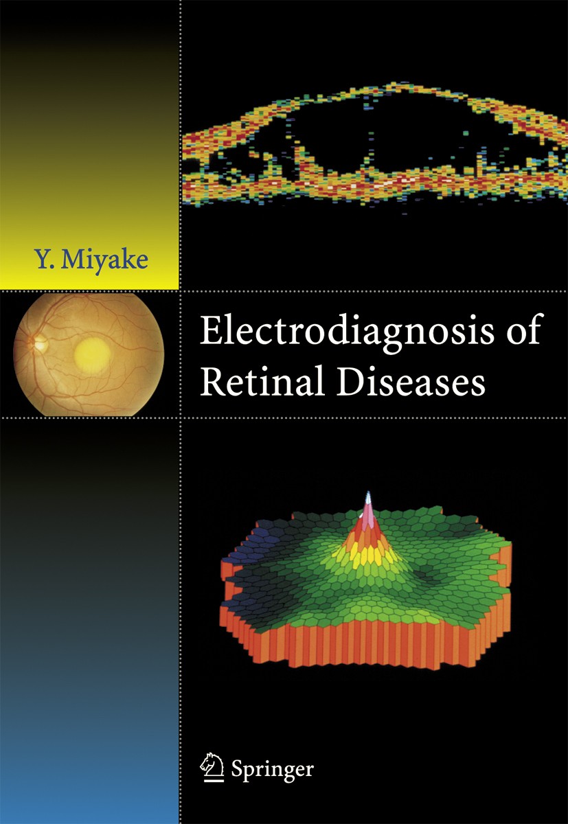 Titlebook: Electrodiagnosis of Retinal Disease; Yozo Miyake Book 2006 Springer-Verlag Tokyo 2006 Electrodiagnosis.Electrophysiology.Full-field ERG.Re Titlebook: Electrodiagnosis of Retinal Disease; Yozo Miyake Book 2006 Springer-Verlag Tokyo 2006 Electrodiagnosis.Electrophysiology.Full-field ERG.Re