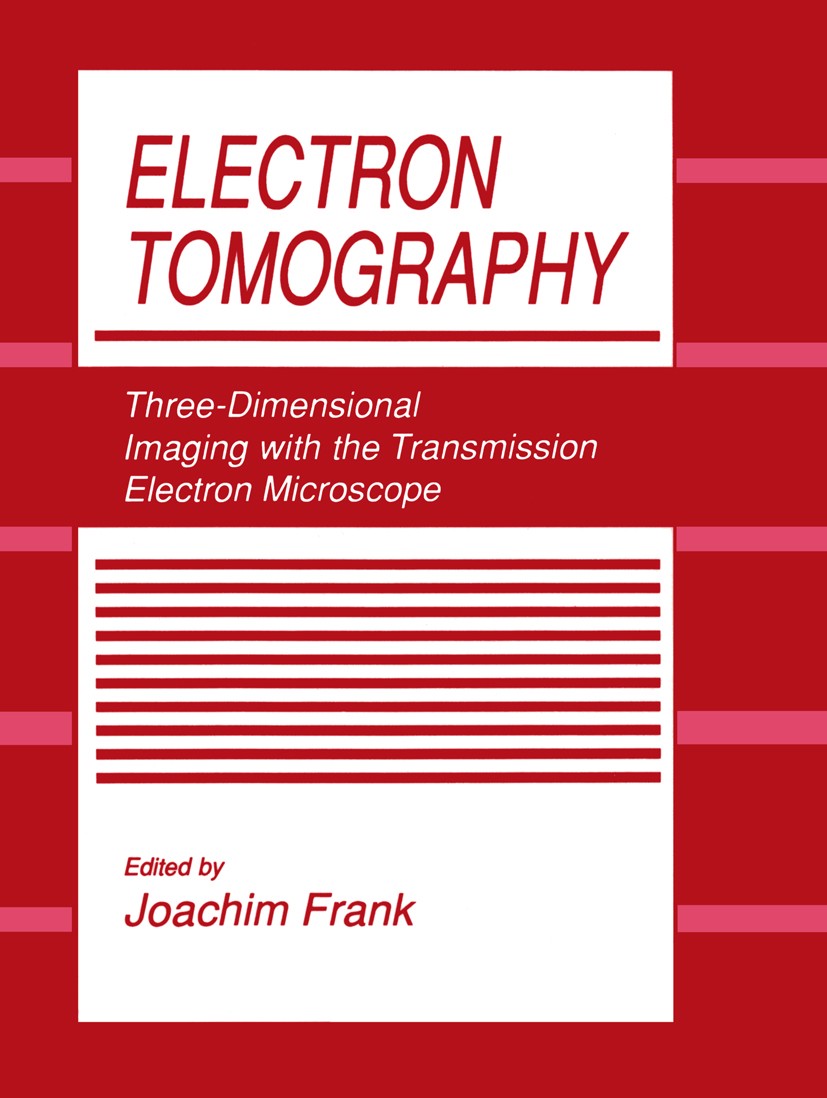 Titlebook: Electron Tomography; Three-Dimensional Im Joachim Frank Book 19921st edition Springer Science+Business Media New York 1992 biological.chrom Titlebook: Electron Tomography; Three-Dimensional Im Joachim Frank Book 19921st edition Springer Science+Business Media New York 1992 biological.chrom