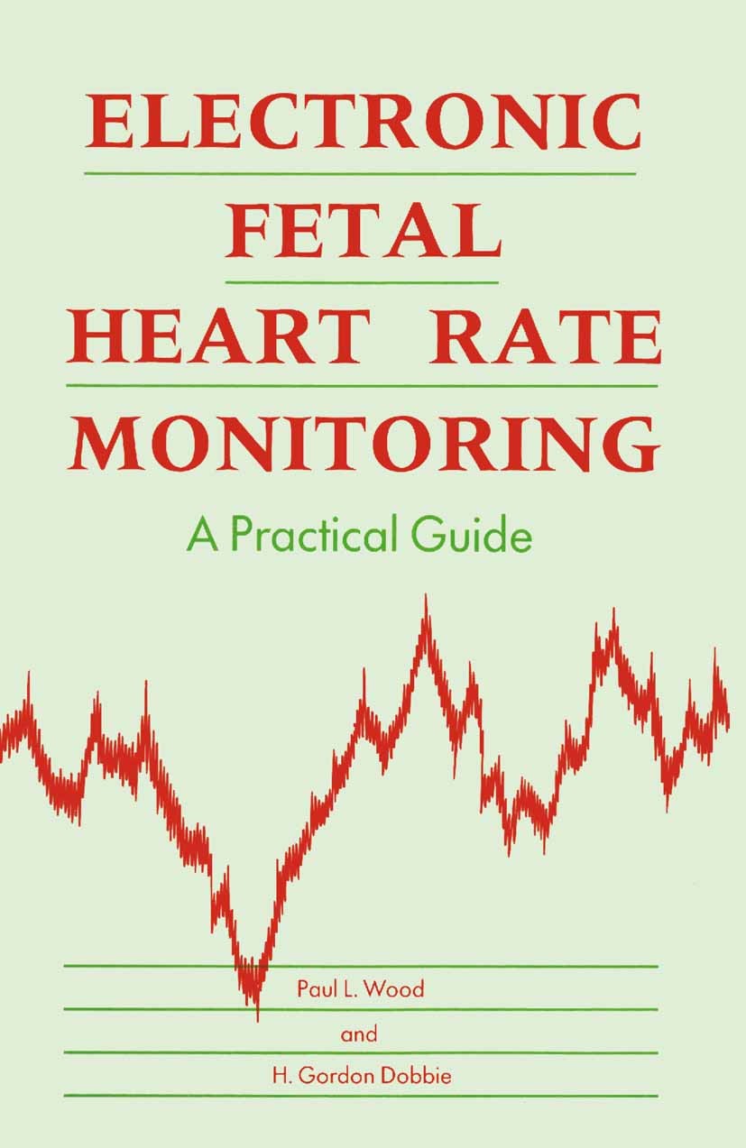 Titlebook: Electronic Fetal Heart Rate Monitoring; A Practical Guide Paul L. Wood,H. Gordon Dobbie Textbook 1989Latest edition Paul L. Wood and H. Gor Titlebook: Electronic Fetal Heart Rate Monitoring; A Practical Guide Paul L. Wood,H. Gordon Dobbie Textbook 1989Latest edition Paul L. Wood and H. Gor