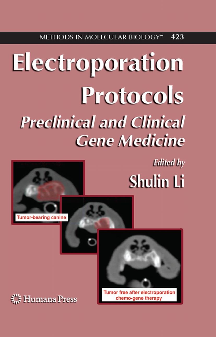 Titlebook: Electroporation Protocols; Preclinical and Clin Shulin Li Book 2008 Humana Press 2008 DNA.Herman.RNA.gene therapy.genes.molecular biology.s Titlebook: Electroporation Protocols; Preclinical and Clin Shulin Li Book 2008 Humana Press 2008 DNA.Herman.RNA.gene therapy.genes.molecular biology.s