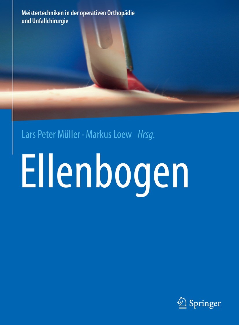 Titlebook: Ellenbogen; Lars Peter Müller,Markus Loew Book 2021 Der/die Herausgeber bzw. der/die Autor(en), exklusiv lizenziert an Springer-Verlag Gmb Titlebook: Ellenbogen; Lars Peter Müller,Markus Loew Book 2021 Der/die Herausgeber bzw. der/die Autor(en), exklusiv lizenziert an Springer-Verlag Gmb