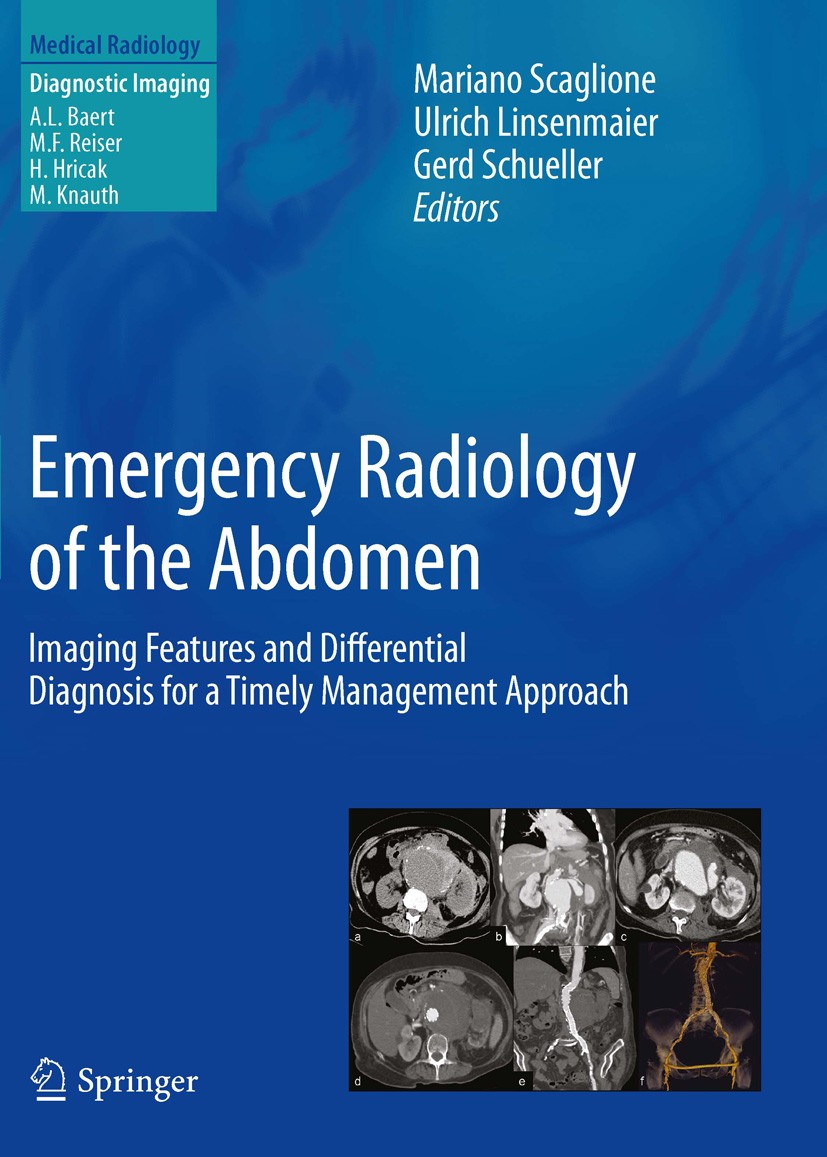 Titlebook: Emergency Radiology of the Abdomen; Imaging Features and Mariano Scaglione,Ulrich Linsenmaier,Gerd Schuelle Book 2012 Springer-Verlag Berli Titlebook: Emergency Radiology of the Abdomen; Imaging Features and Mariano Scaglione,Ulrich Linsenmaier,Gerd Schuelle Book 2012 Springer-Verlag Berli