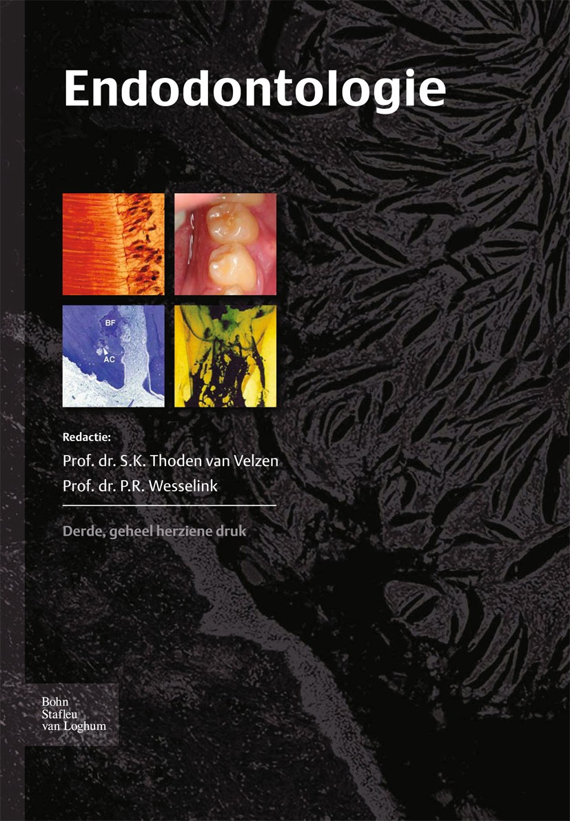 Titlebook: Endodontologie; Studenteneditie S.K. Thoden Velzen,P.R. Wesselink Book 2010Latest edition Bohn Stafleu van Loghum 2010 Titlebook: Endodontologie; Studenteneditie S.K. Thoden Velzen,P.R. Wesselink Book 2010Latest edition Bohn Stafleu van Loghum 2010