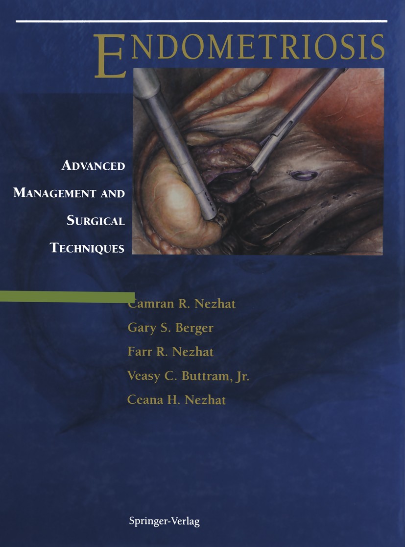 Titlebook: Endometriosis; Advanced Management Camran R. Nezhat,Gary S. Berger,Ceana H. Nezhat Book 1995 Springer-Verlag New York, Inc. 1995 complicat Titlebook: Endometriosis; Advanced Management Camran R. Nezhat,Gary S. Berger,Ceana H. Nezhat Book 1995 Springer-Verlag New York, Inc. 1995 complicat