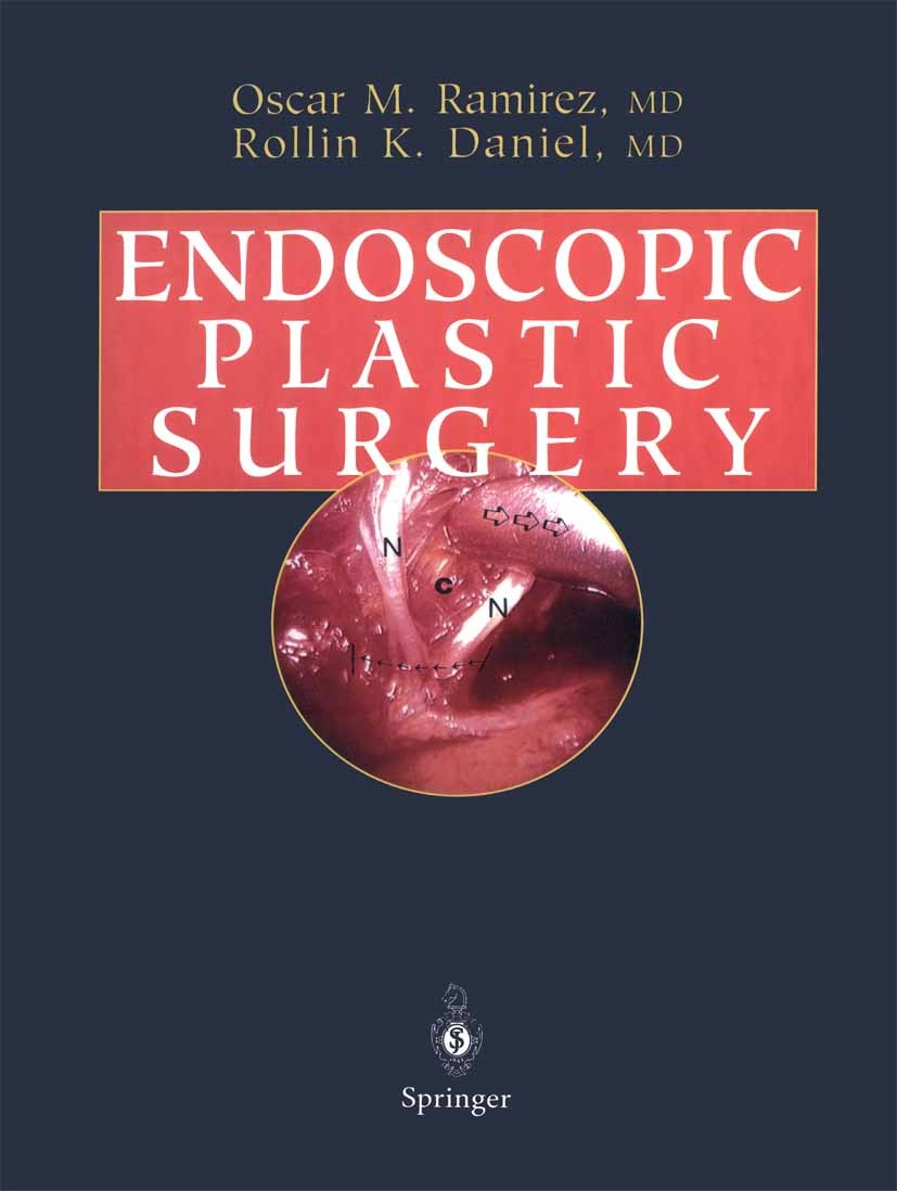 Titlebook: Endoscopic Plastic Surgery; Oscar M. Ramirez,Rollin K. Daniel Book 1996 Springer-Verlag New York Inc. 1996 aesthetic surgery.plastic surge Titlebook: Endoscopic Plastic Surgery; Oscar M. Ramirez,Rollin K. Daniel Book 1996 Springer-Verlag New York Inc. 1996 aesthetic surgery.plastic surge
