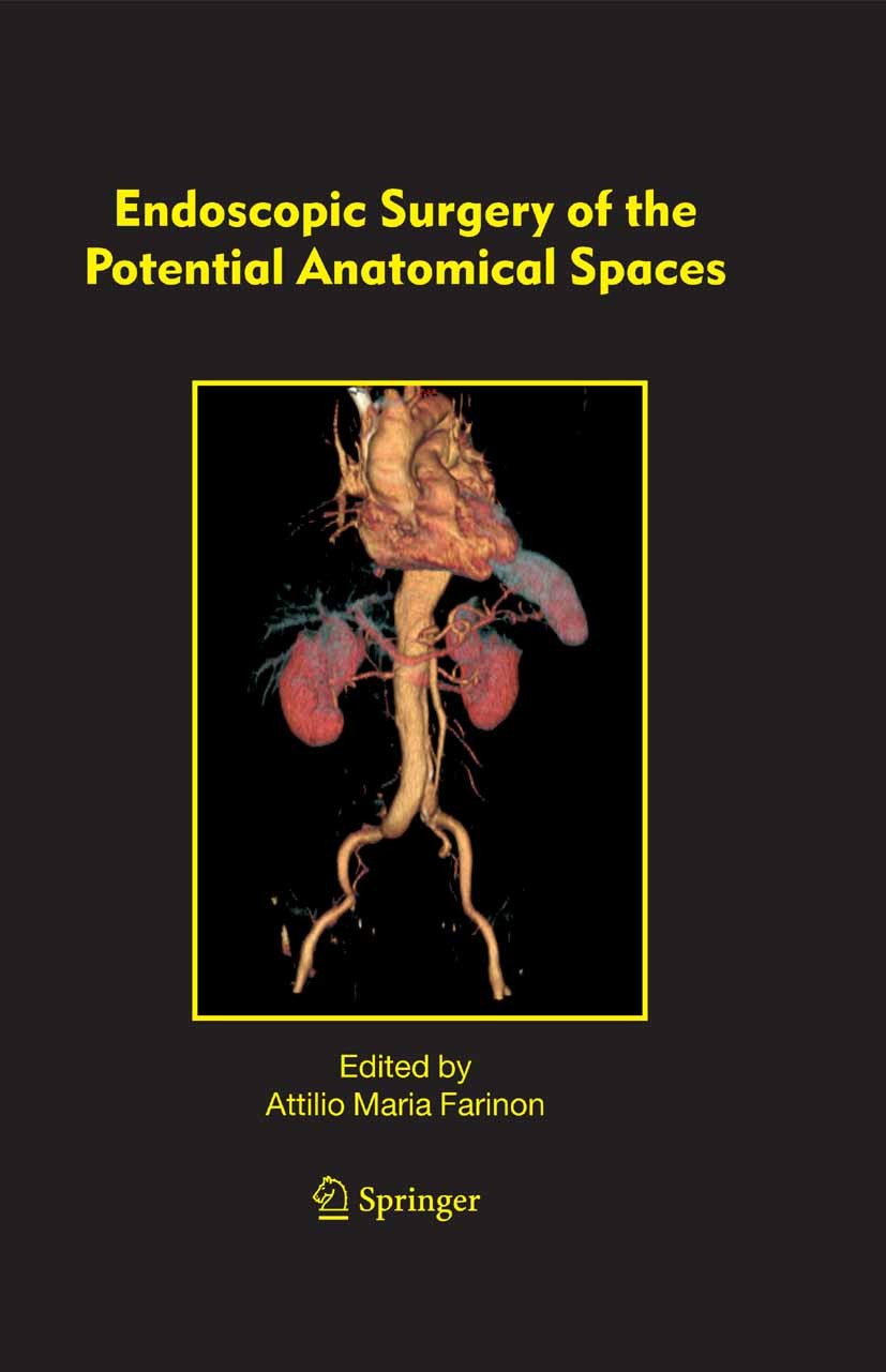 Titlebook: Endoscopic Surgery of the Potential Anatomical Spaces; Attilio Maria Farinon (Professor of Surgery and Ch Book 2005 Springer Science+Busin Titlebook: Endoscopic Surgery of the Potential Anatomical Spaces; Attilio Maria Farinon (Professor of Surgery and Ch Book 2005 Springer Science+Busin
