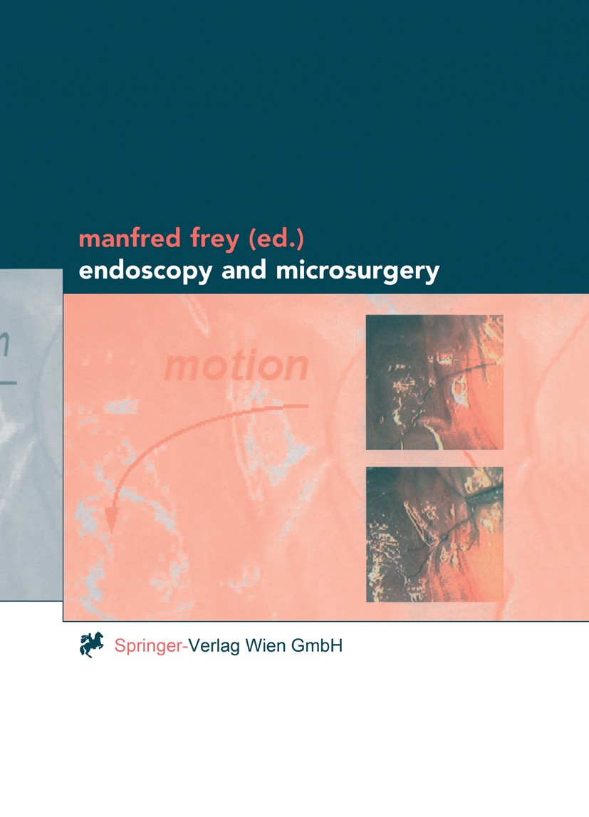 Titlebook: Endoscopy and Microsurgery; Manfred Frey (Professor and Head of the Division o Book 2001 Springer-Verlag Wien 2001 3D-Endoskopie.Endoscopi Titlebook: Endoscopy and Microsurgery; Manfred Frey (Professor and Head of the Division o Book 2001 Springer-Verlag Wien 2001 3D-Endoskopie.Endoscopi