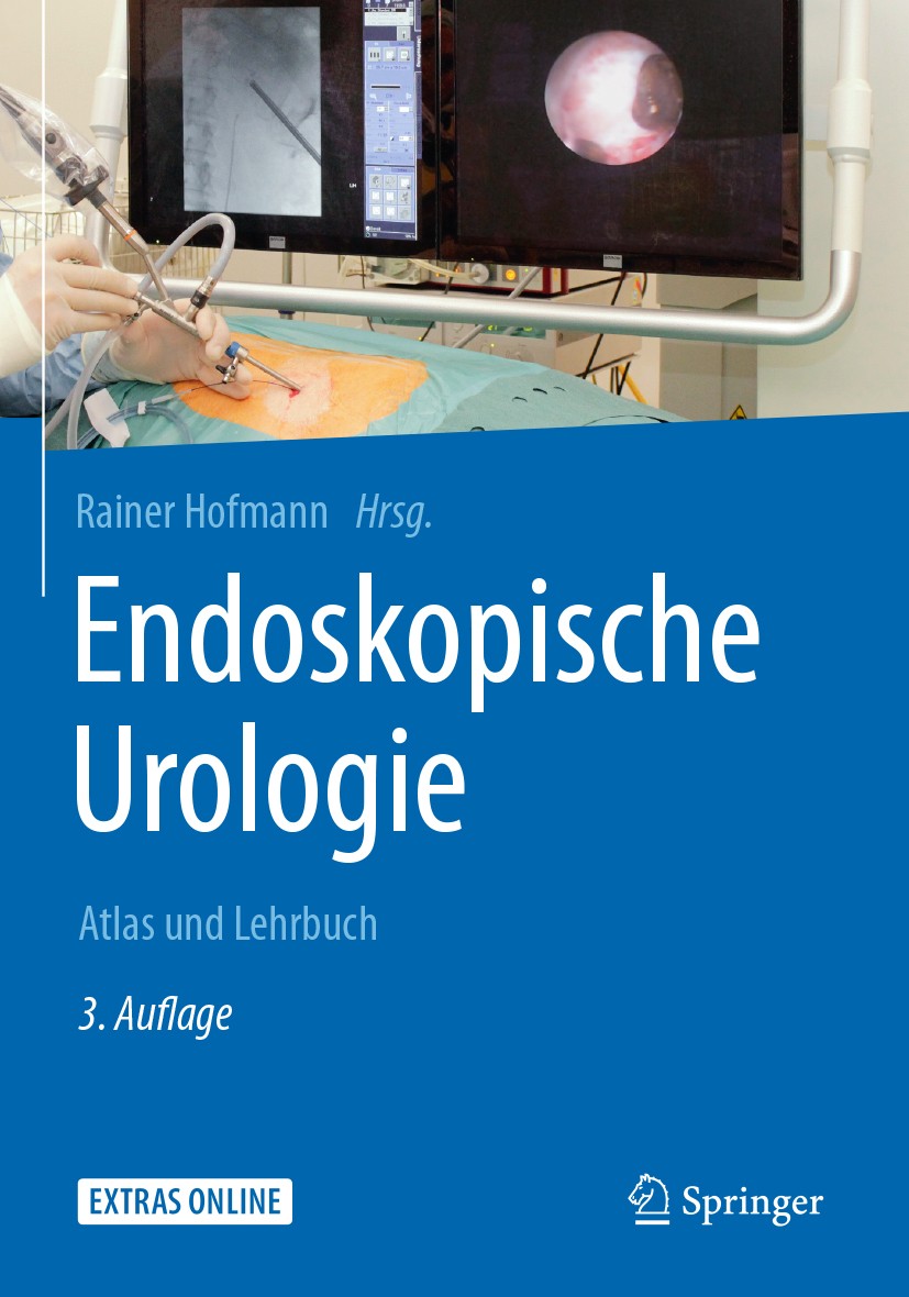 Titlebook: Endoskopische Urologie; Atlas und Lehrbuch Rainer Hofmann Book 2018Latest edition Springer-Verlag GmbH Deutschland 2018 Endourologie.minima Titlebook: Endoskopische Urologie; Atlas und Lehrbuch Rainer Hofmann Book 2018Latest edition Springer-Verlag GmbH Deutschland 2018 Endourologie.minima