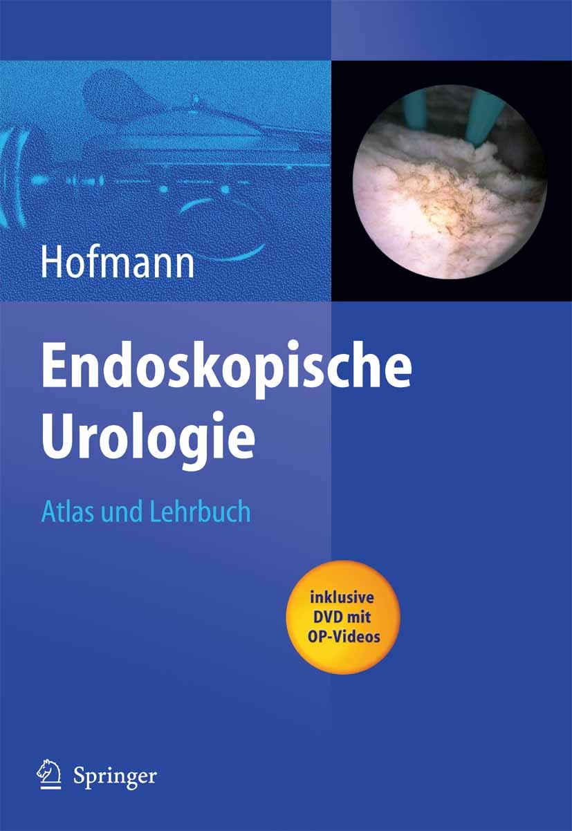 Titlebook: Endoskopische Urologie; Atlas und Lehrbuch Rainer Hofmann (Direktor) Book 20051st edition Springer-Verlag Berlin Heidelberg 2005 Anatomie.B Titlebook: Endoskopische Urologie; Atlas und Lehrbuch Rainer Hofmann (Direktor) Book 20051st edition Springer-Verlag Berlin Heidelberg 2005 Anatomie.B