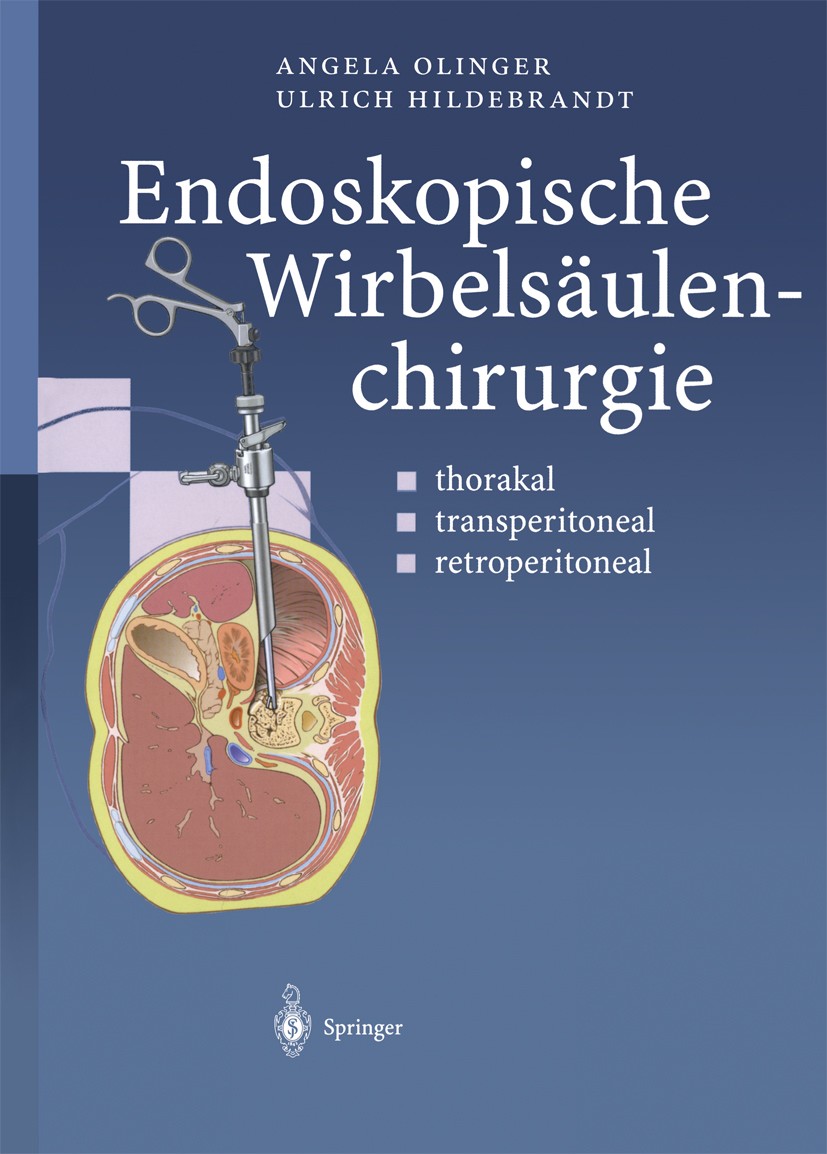 Titlebook: Endoskopische Wirbelsäulenchirurgie; thorakal · transperi Angela Olinger,Ulrich Hildebrandt Book 2000 Springer-Verlag Berlin Heidelberg 200 Titlebook: Endoskopische Wirbelsäulenchirurgie; thorakal · transperi Angela Olinger,Ulrich Hildebrandt Book 2000 Springer-Verlag Berlin Heidelberg 200