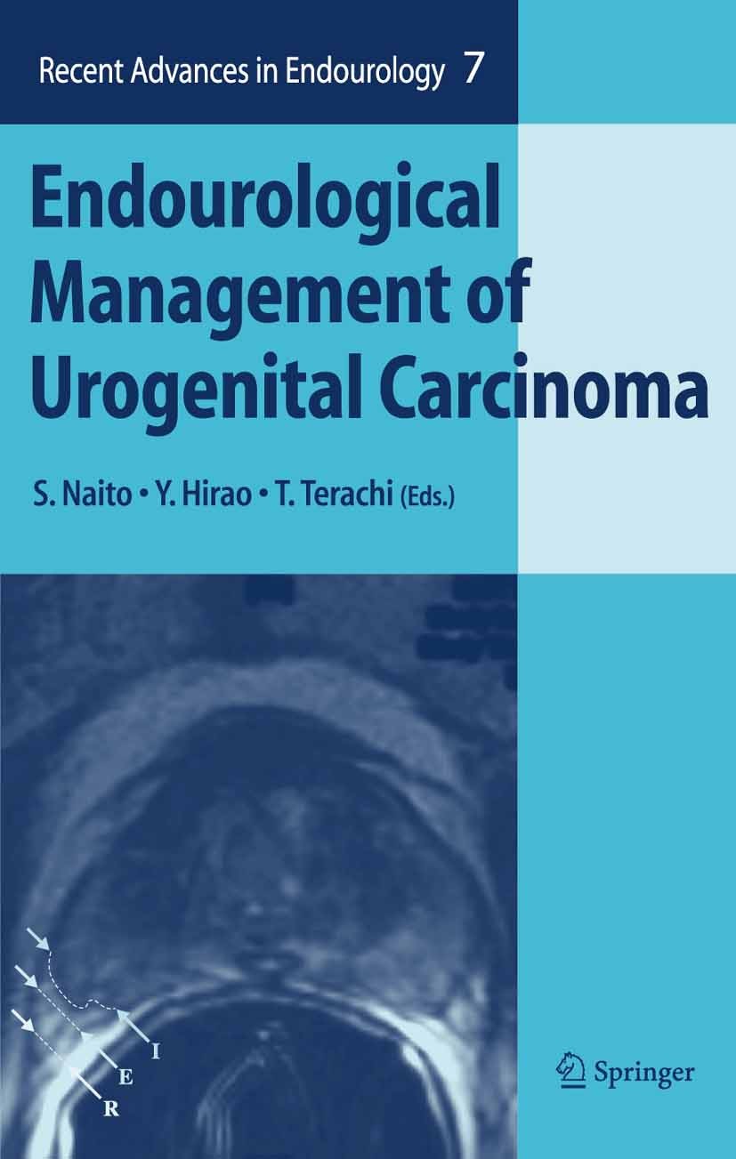 Titlebook: Endourological Management of Urogenital Carcinoma; Seiji Naito (Professor and Chairman),Yoshihiko Hir Book 2006 Springer-Verlag Tokyo 2006 Titlebook: Endourological Management of Urogenital Carcinoma; Seiji Naito (Professor and Chairman),Yoshihiko Hir Book 2006 Springer-Verlag Tokyo 2006