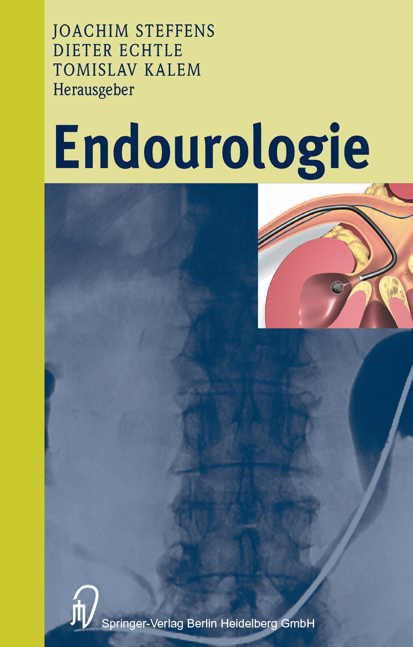 Titlebook: Endourologie; Joachim Steffens (Chefarzt der Klinik für Urologie Book 2003 Springer-Verlag Berlin Heidelberg 2003 Blase.Endourologie.Harnl Titlebook: Endourologie; Joachim Steffens (Chefarzt der Klinik für Urologie Book 2003 Springer-Verlag Berlin Heidelberg 2003 Blase.Endourologie.Harnl