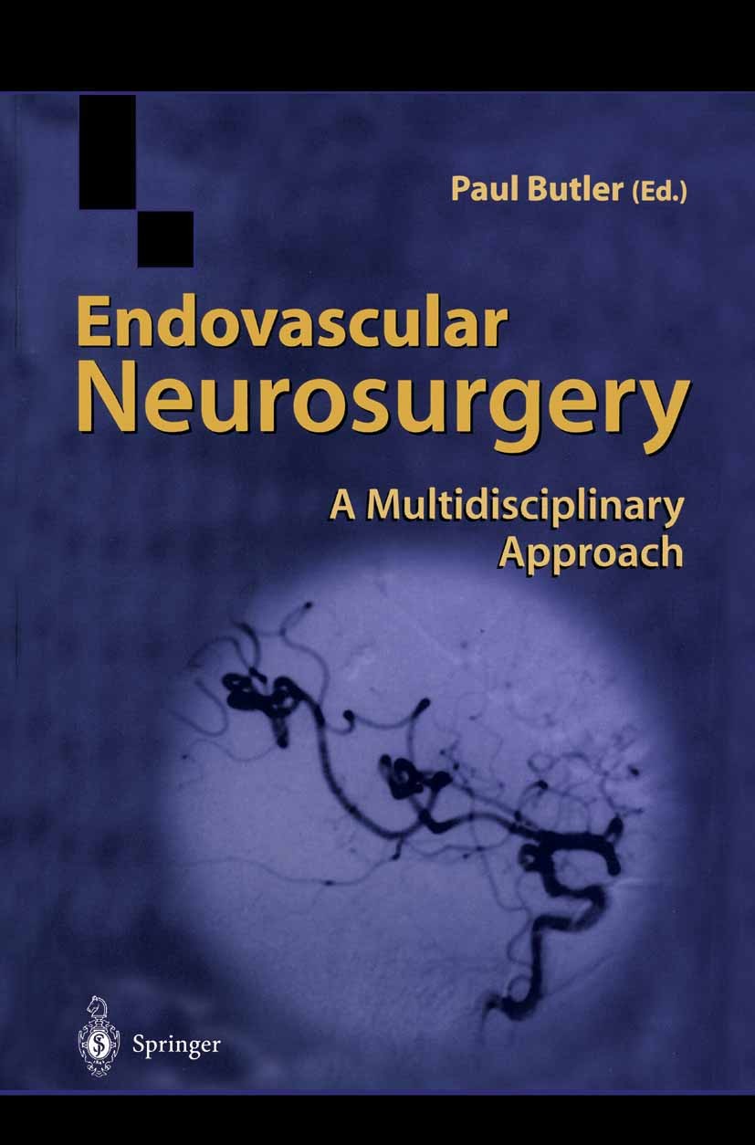 Titlebook: Endovascular Neurosurgery; A Multidisciplinary Paul Butler (Consultant Neuroradiologist) Book 2000 Springer-Verlag London 2000 aneurysm.ne Titlebook: Endovascular Neurosurgery; A Multidisciplinary Paul Butler (Consultant Neuroradiologist) Book 2000 Springer-Verlag London 2000 aneurysm.ne