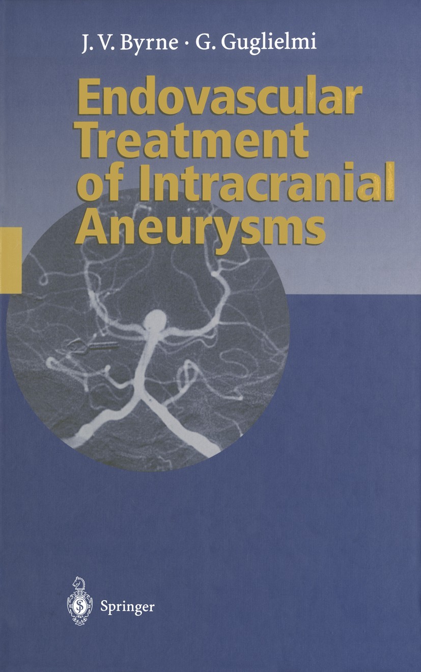 Titlebook: Endovascular Treatment of Intracranial Aneurysms; James V. Byrne,Guido Guglielmi Book 1998 Springer-Verlag Berlin · Heidelberg 1998 Aneury Titlebook: Endovascular Treatment of Intracranial Aneurysms; James V. Byrne,Guido Guglielmi Book 1998 Springer-Verlag Berlin · Heidelberg 1998 Aneury