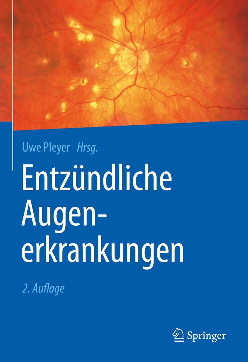 Titlebook: Entzündliche Augenerkrankungen; Uwe Pleyer Book 2021Latest edition Springer-Verlag GmbH Deutschland, ein Teil von Springer Nature 2021 Uve Titlebook: Entzündliche Augenerkrankungen; Uwe Pleyer Book 2021Latest edition Springer-Verlag GmbH Deutschland, ein Teil von Springer Nature 2021 Uve