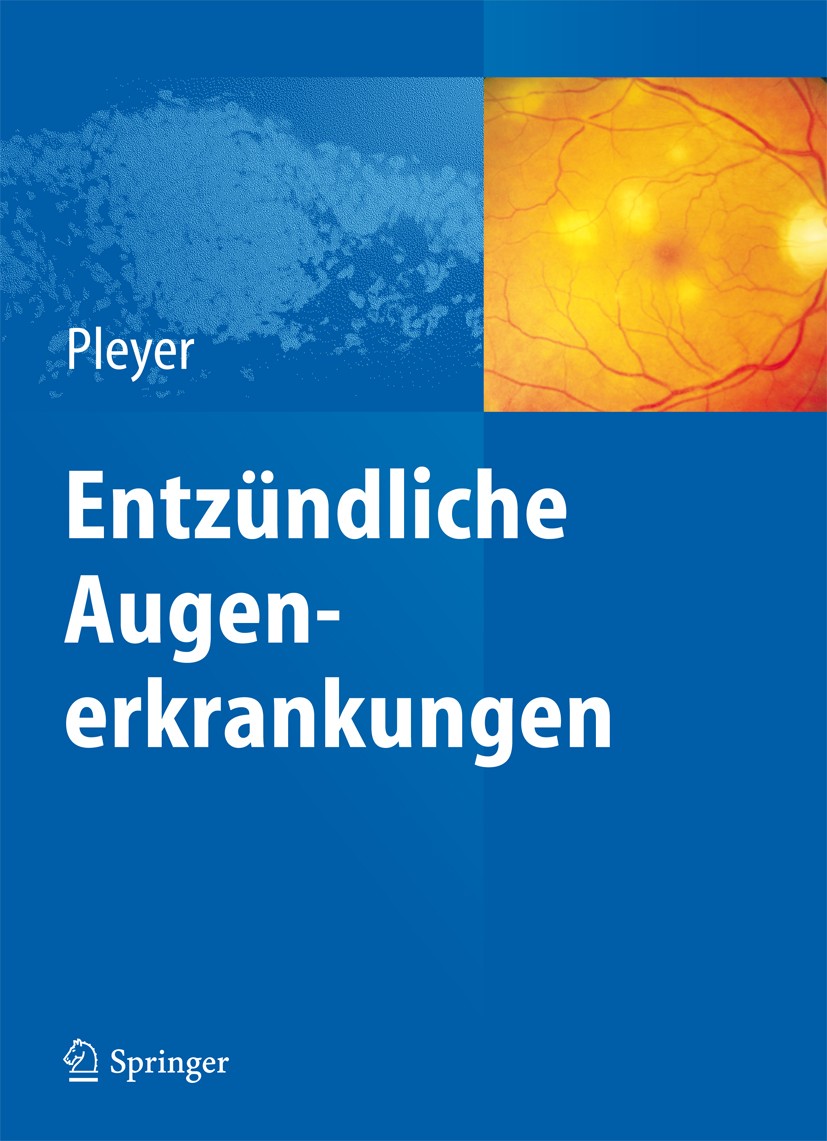 Titlebook: Entzündliche Augenerkrankungen; Uwe Pleyer Book 20141st edition Springer-Verlag Berlin Heidelberg 2014 Uveitis anterior.Uveitis intermedia Titlebook: Entzündliche Augenerkrankungen; Uwe Pleyer Book 20141st edition Springer-Verlag Berlin Heidelberg 2014 Uveitis anterior.Uveitis intermedia