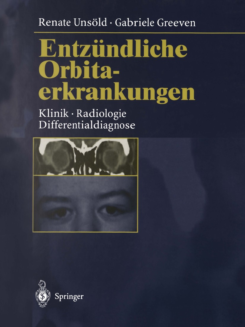 Titlebook: Entzündliche Orbitaerkrankungen; Klinik · Radiologie Renate Unsöld,Gabriele Greeven Book 1997 Springer-Verlag Berlin Heidelberg 1997 Diagn Titlebook: Entzündliche Orbitaerkrankungen; Klinik · Radiologie Renate Unsöld,Gabriele Greeven Book 1997 Springer-Verlag Berlin Heidelberg 1997 Diagn