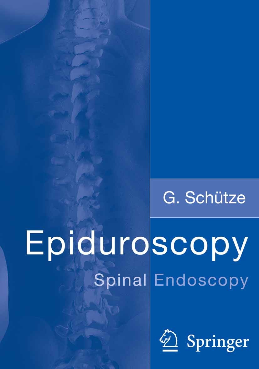Titlebook: Epiduroscopy; Spinal Endoscopy G. Schütze Book 2008 Springer-Verlag Berlin Heidelberg 2008 Anaesthesiology.biopsy.complication.complication Titlebook: Epiduroscopy; Spinal Endoscopy G. Schütze Book 2008 Springer-Verlag Berlin Heidelberg 2008 Anaesthesiology.biopsy.complication.complication
