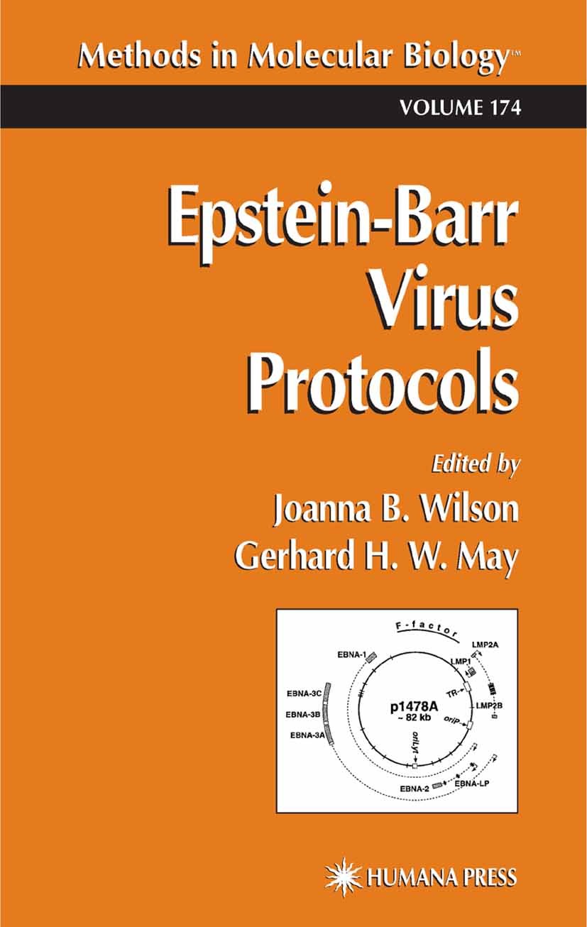 Titlebook: Epstein-Barr Virus Protocols; Joanna B. Wilson,Gerhard H. W. May Book 2001 Humana Press 2001 Titlebook: Epstein-Barr Virus Protocols; Joanna B. Wilson,Gerhard H. W. May Book 2001 Humana Press 2001