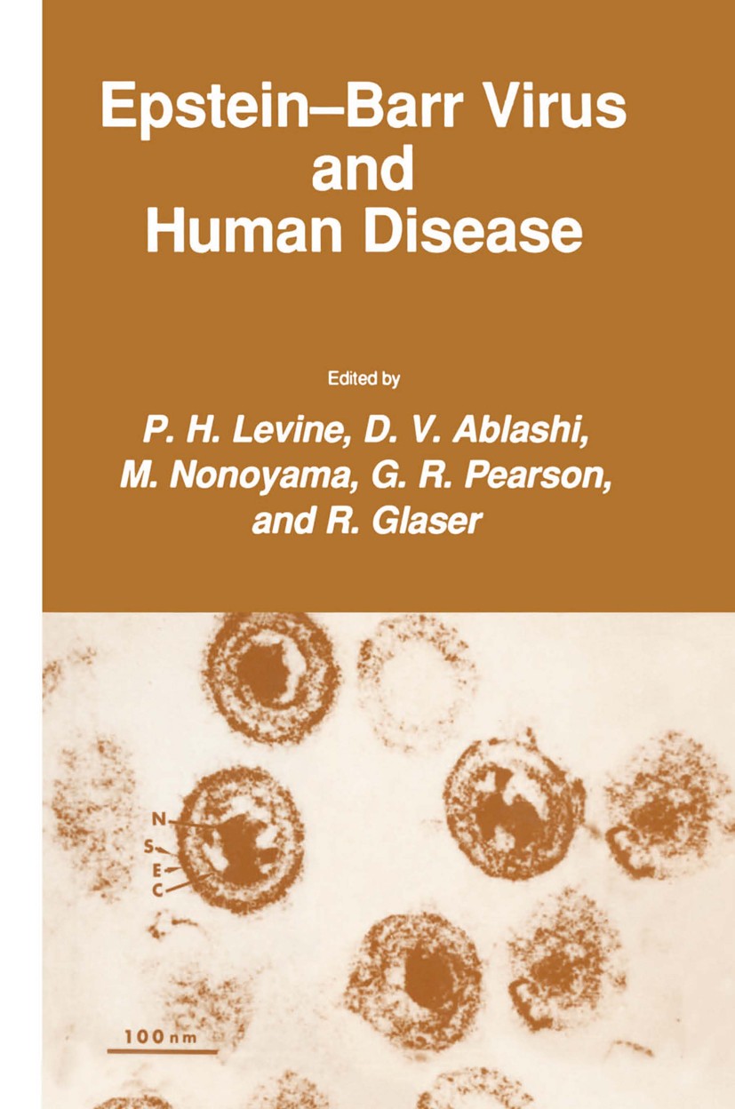 Titlebook: Epstein-Barr Virus and Human Disease; P. H. Levine,D. V. Ablashi,R. Glaser Book 1987 The Humana Press Inc. 1987 AIDS.Antigen.blood.disease Titlebook: Epstein-Barr Virus and Human Disease; P. H. Levine,D. V. Ablashi,R. Glaser Book 1987 The Humana Press Inc. 1987 AIDS.Antigen.blood.disease