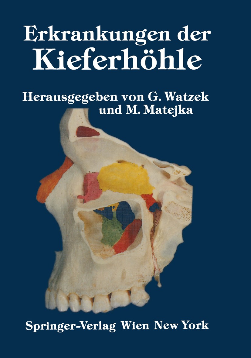 Titlebook: Erkrankungen der Kieferhöhle; Symposium, Fuschl, 2 Georg Watzek,Michael Matejka Conference proceedings 1986 Springer-Verlag/Wien 1986 Bezie Titlebook: Erkrankungen der Kieferhöhle; Symposium, Fuschl, 2 Georg Watzek,Michael Matejka Conference proceedings 1986 Springer-Verlag/Wien 1986 Bezie