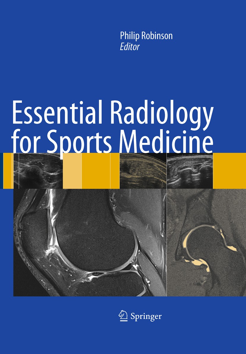 Titlebook: Essential Radiology for Sports Medicine; Philip Robinson Book 2010 Springer Science+Business Media, LLC 2010 Arthrography.Computed Tomogra Titlebook: Essential Radiology for Sports Medicine; Philip Robinson Book 2010 Springer Science+Business Media, LLC 2010 Arthrography.Computed Tomogra