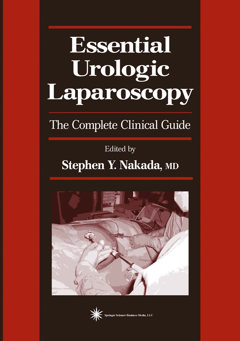 Titlebook: Essential Urologic Laparoscopy; The Complete Clinica Stephen Y. Nakada Book 20031st edition Springer Science+Business Media New York 2003 A Titlebook: Essential Urologic Laparoscopy; The Complete Clinica Stephen Y. Nakada Book 20031st edition Springer Science+Business Media New York 2003 A