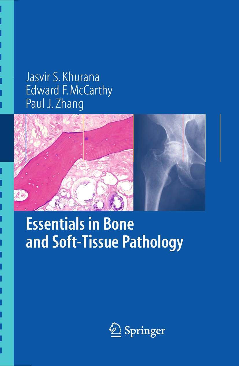 Titlebook: Essentials in Bone and Soft-Tissue Pathology; Jasvir S. Khurana,Edward F. McCarthy,Paul J. Zhang Book 2010 Springer-Verlag US 2010 Arthrop Titlebook: Essentials in Bone and Soft-Tissue Pathology; Jasvir S. Khurana,Edward F. McCarthy,Paul J. Zhang Book 2010 Springer-Verlag US 2010 Arthrop
