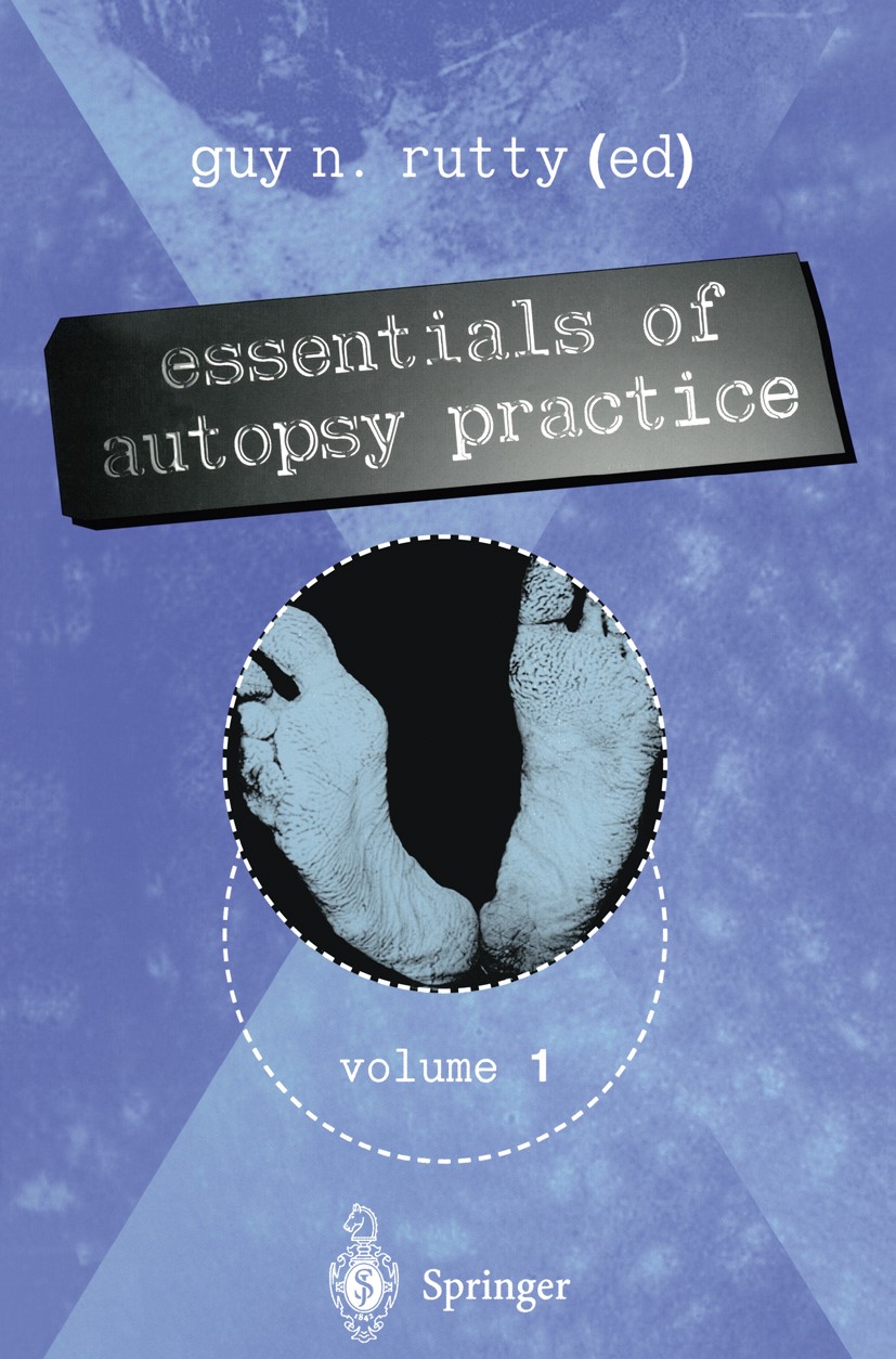 Titlebook: Essentials of Autopsy Practice; Volume 1 Guy N. Rutty Book 2001 Springer-Verlag London Limited 2001 Autopsy practice.ageing.aging.child.chi Titlebook: Essentials of Autopsy Practice; Volume 1 Guy N. Rutty Book 2001 Springer-Verlag London Limited 2001 Autopsy practice.ageing.aging.child.chi