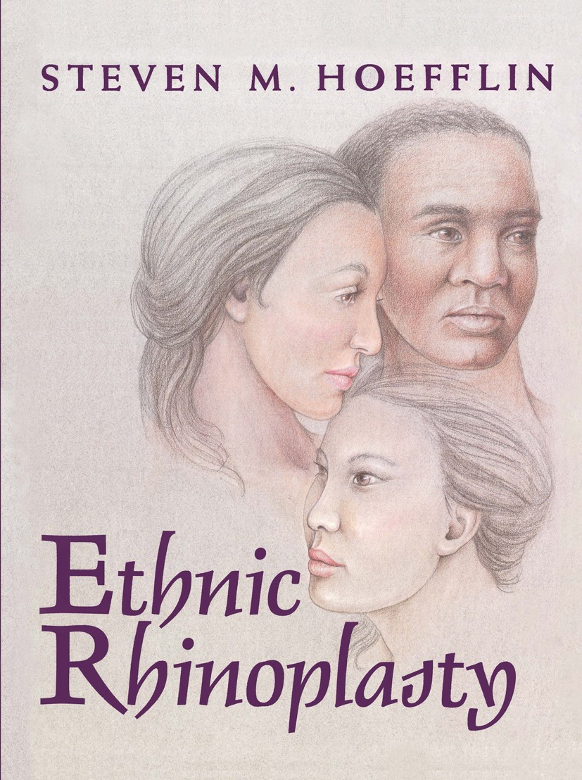 Titlebook: Ethnic Rhinoplasty; Steven M. Hoefflin Book 1998 Springer Science+Business Media New York 1998 anatomy.base.basics.complication.complicati Titlebook: Ethnic Rhinoplasty; Steven M. Hoefflin Book 1998 Springer Science+Business Media New York 1998 anatomy.base.basics.complication.complicati